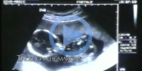 Ultrasound of baby in womb; play button to go to video
